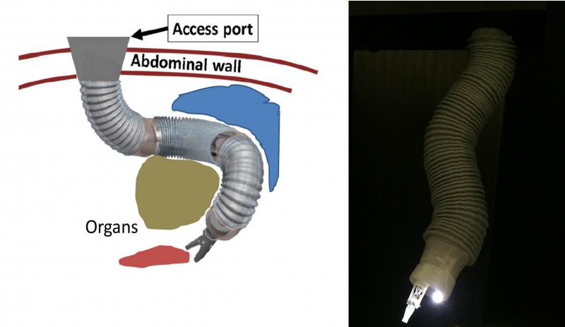 abdomnial