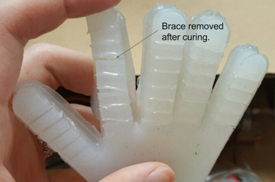 brace_removed