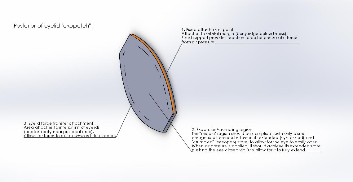 Description of pneumatic exopatch
